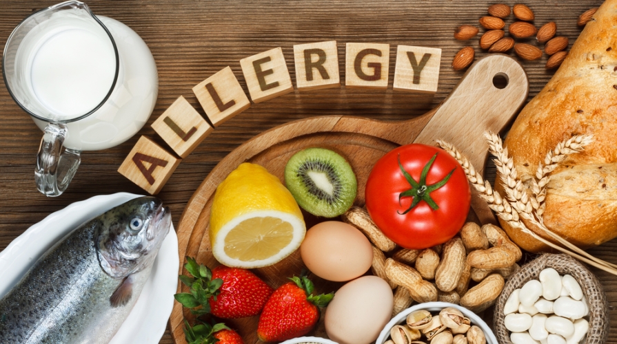 allergie alimentari