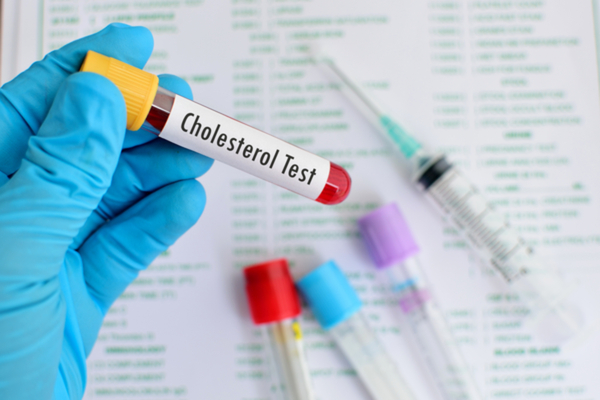 colesterolo test